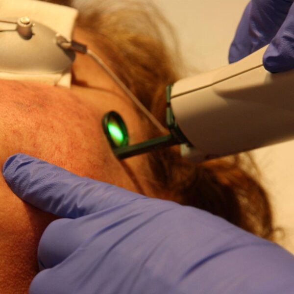 C-LM consigue una inversión de 11,3 millones de euros en la modernización de equipos hospitalarios