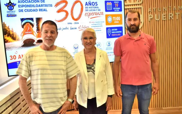 Acto del 30 aniversario de la asociación de espondiloartritis